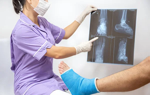Fracture Management